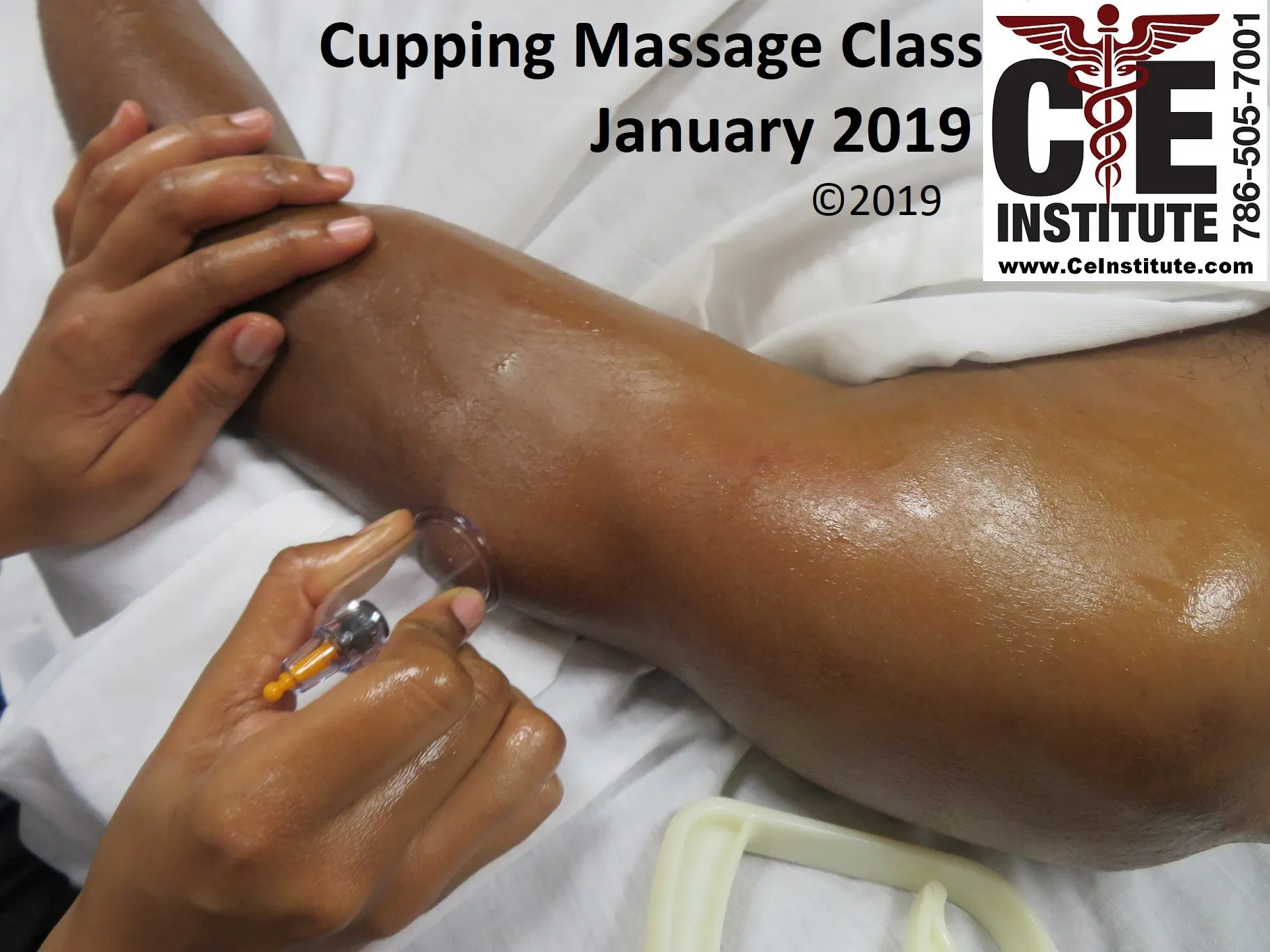 12 CE Hour Orthopedic Cupping (Computer-Based Live Interactive Webinar)