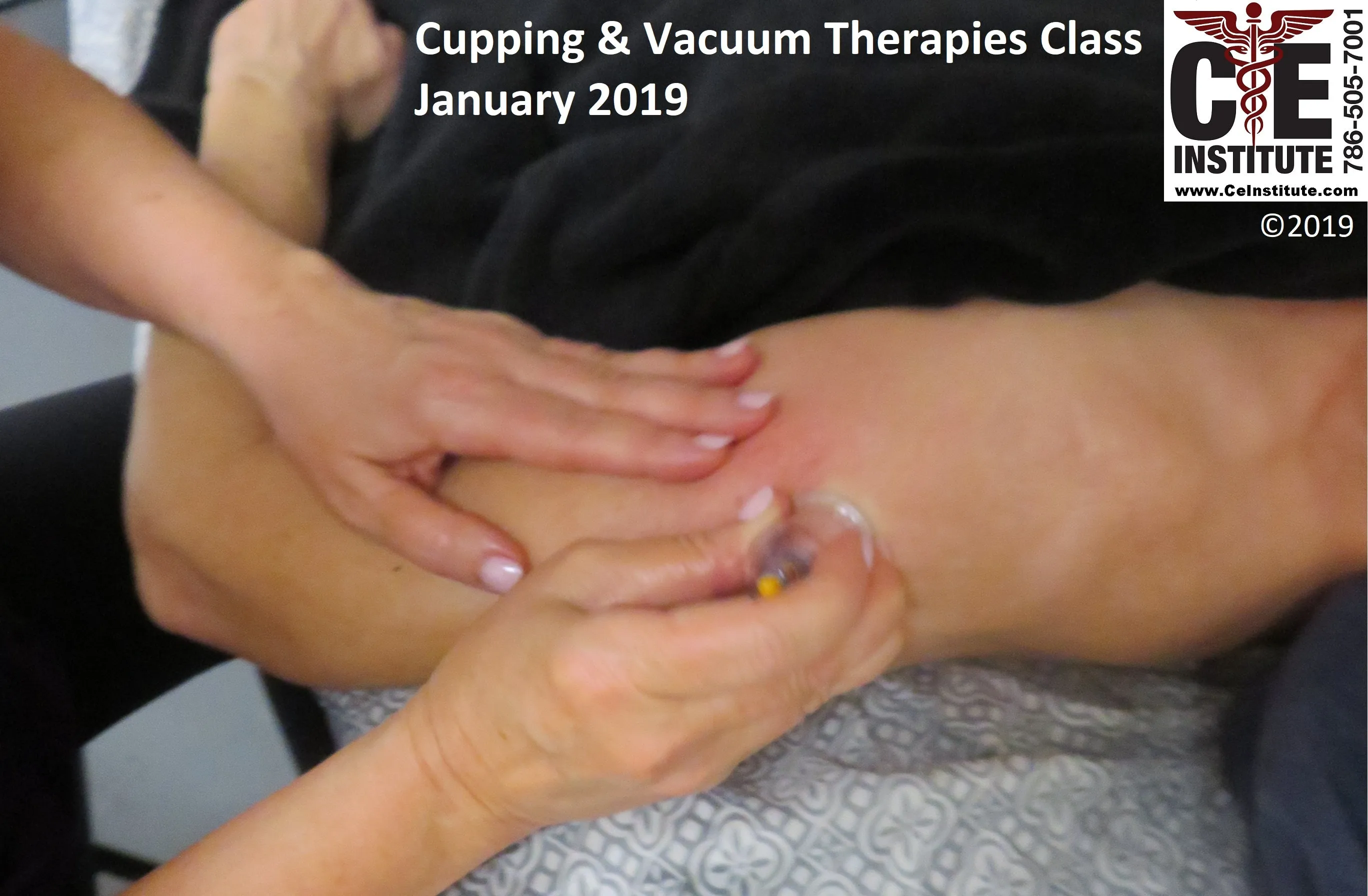 12 CE Hour Orthopedic Cupping (Computer-Based Live Interactive Webinar)