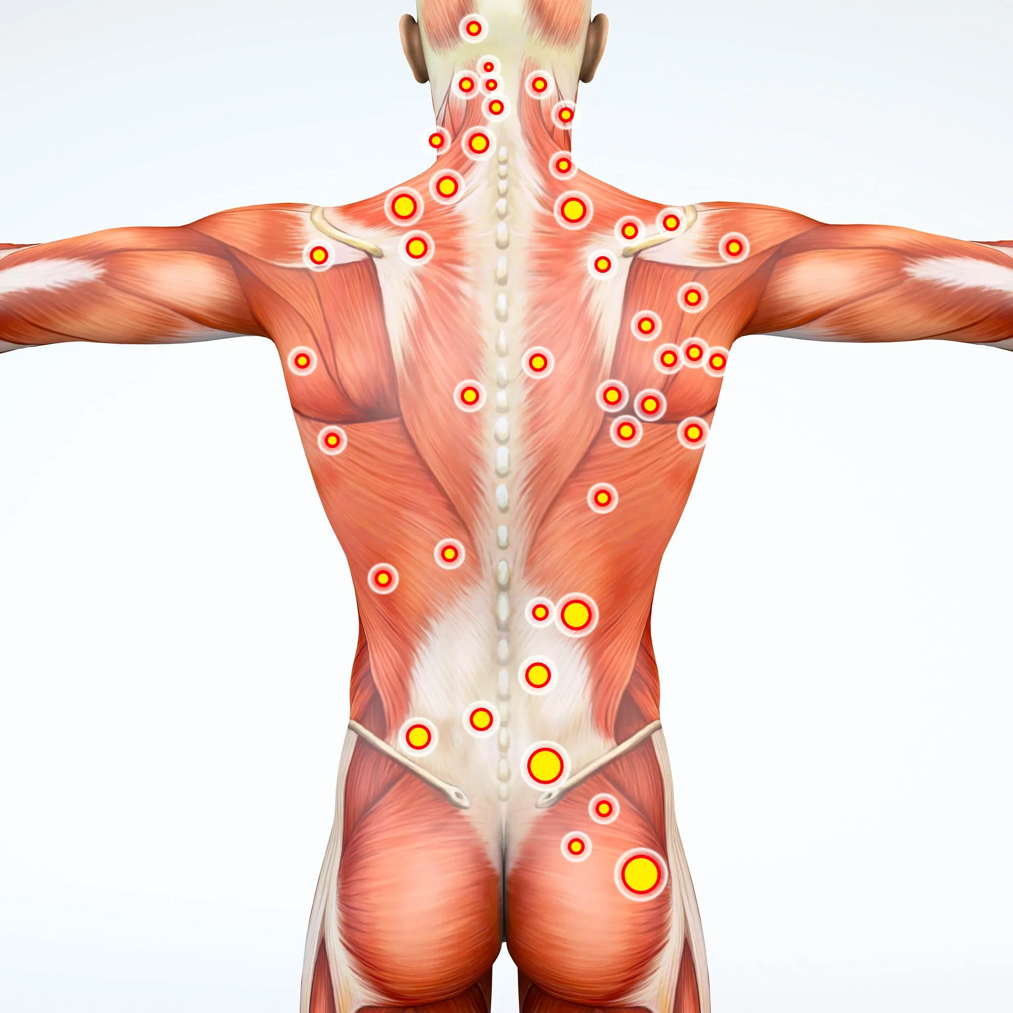 12 CE Hour Trigger Point Therapy & Myofascial Release (Computer-Based Live Interactive Webinar)