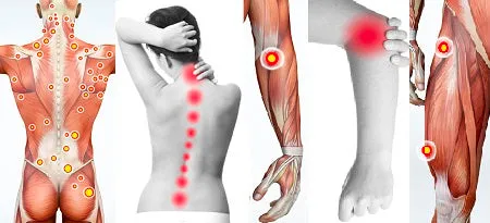 6 CE Hour Trigger Point Therapy (Computer-Based Live Interactive Webinar)